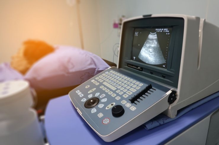 Ovary Ultrasound