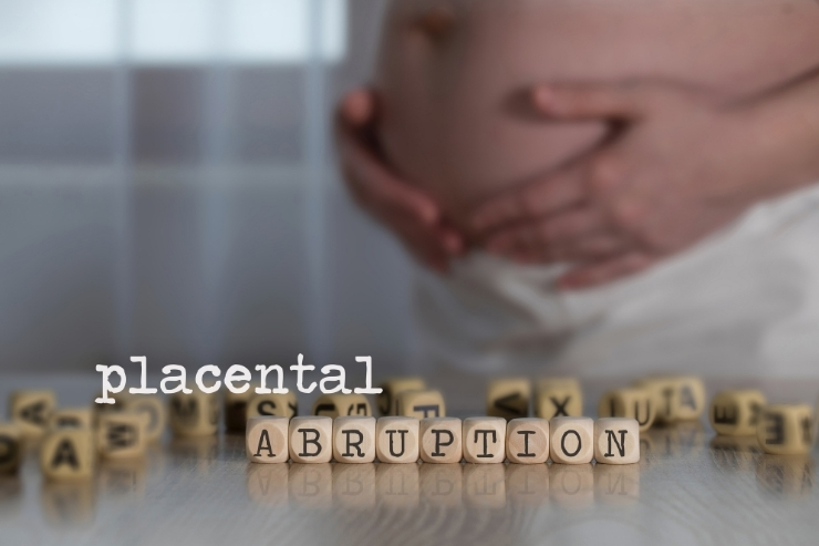 Placental Abruption Management